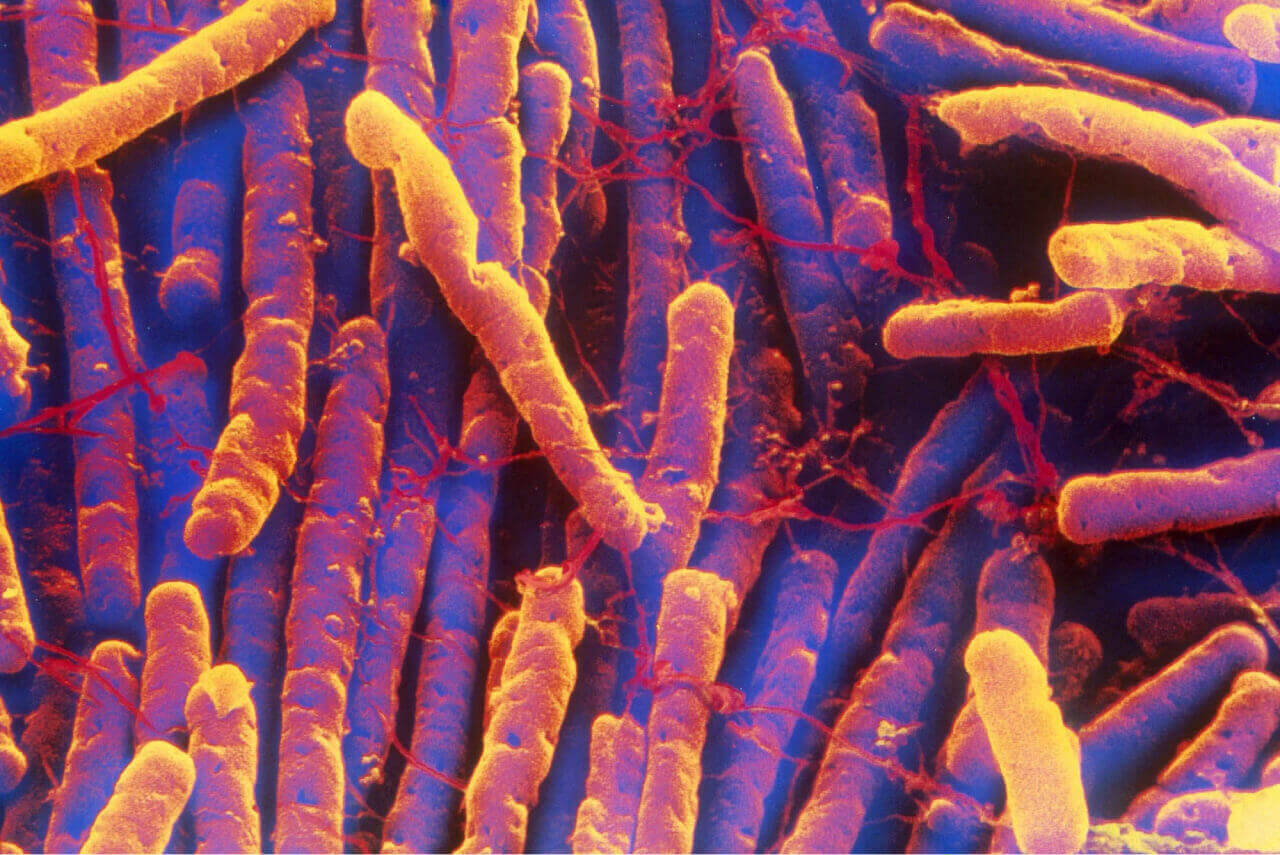 Why is C. Diff So Hard to Culture and Kill?